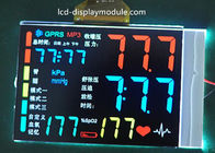 Yüksek Çözünürlüklü Dot Matrix LCD Ekran Modülü Beyaz LED VA Segmenti FPC Tipi
